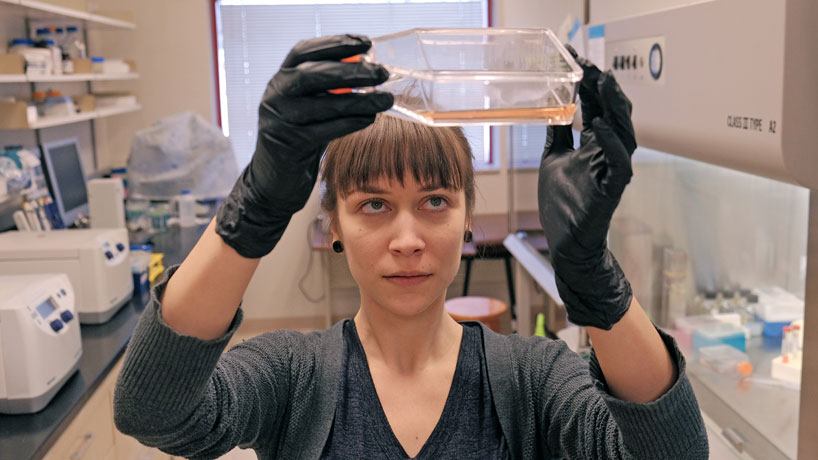 Senior biology major Christine Noto studies human neural cells for her research on Parkinson's gene LRRK2, for which she won a College of Arts and Sciences Undergraduate Research Grant.