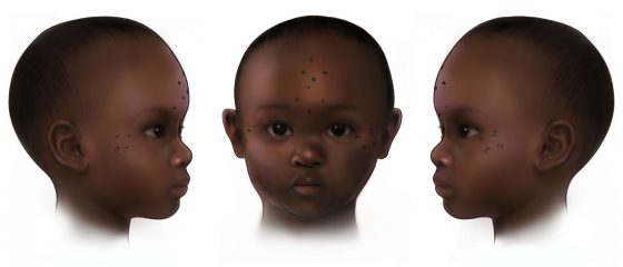 An illustration showing tattoos on the faces of young children. Some of the tattoos are made up of dots, arranged in the shape of a cross on the forehead.
